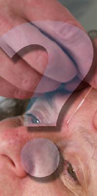 patient receiving acupuncture